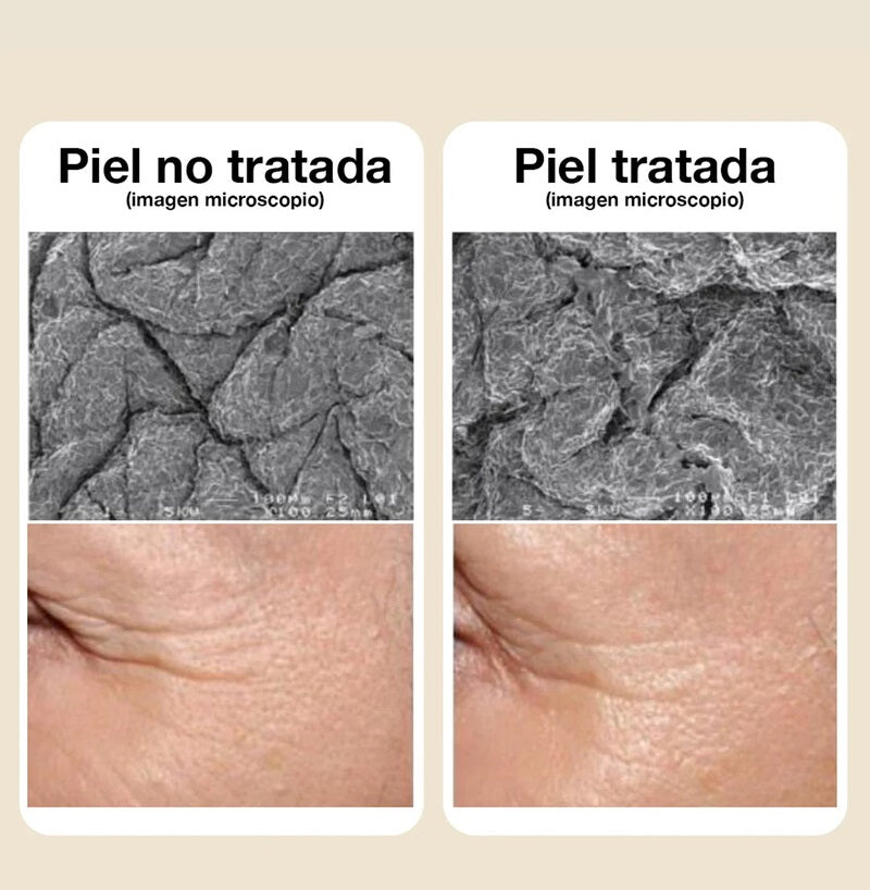 Contorno para Ojos